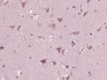 Phospho-c-Kit (Tyr721) Rabbit 