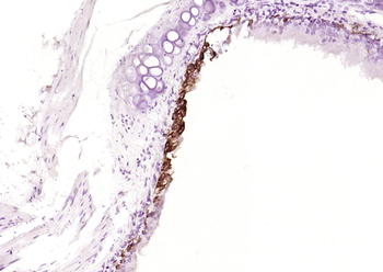 Cytokeratin 5 Recombinant Rabb