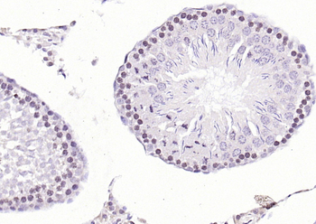 CDK6 Rabbit Polyclonal Antibod