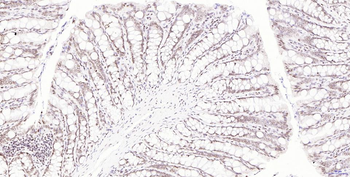 Phospho-H2AX (Ser139) Recombin