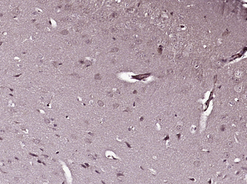 PDK1/Mitochondrial Pyruvate de
