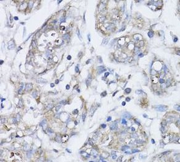 BRCA1 Antibody抗体,orb625170,bio