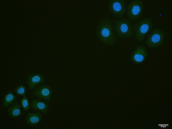 Phospho-eIF4EBP1 (Thr37 + Thr4