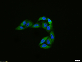 Phospho-ATG1 (Ser556) Rabbit P