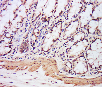 EXOSC7 Rabbit Polyclonal Antib