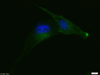 Alpha smooth muscle Actin Reco