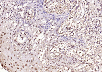 PPM1D Rabbit Polyclonal Antibo