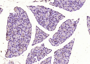 Musashi 1 Rabbit Polyclonal An