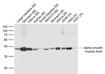 Alpha smooth muscle Actin Reco
