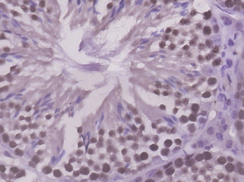 PRC1 Rabbit Polyclonal Antibod