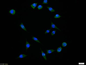 Phospho-PDGFRA (Tyr849)/ PDGFR