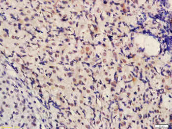 Phospho-BRCA1 (Ser1189) Rabbit