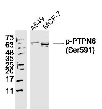 Phospho-PTPN6 (Ser591) Rabbit 