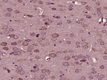 HRG beta 1 Rabbit Polyclonal A