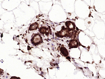 Phospho-YAP1 (Tyr407) Rabbit P