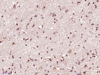 CDK6 Rabbit Polyclonal Antibod