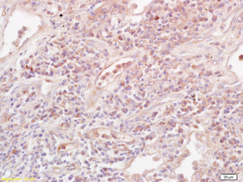 IL-10 Rabbit Polyclonal Antibo