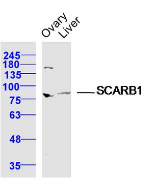 SCARB1/Scavenger Receptor BI R