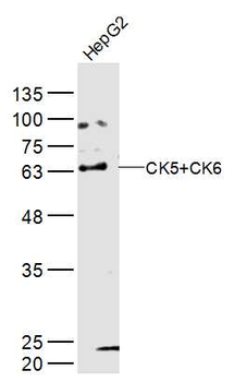 CK5+CK6 Rabbit Polyclonal Anti