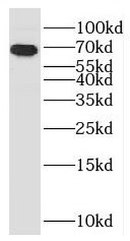 CCDC7 Antibody抗体,orb625220,bio