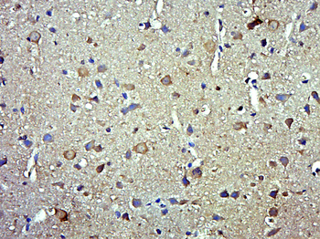 Phospho-Smad3 (Ser208) Rabbit 