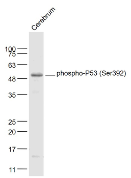 Phospho-P53 (Ser392) Rabbit Po