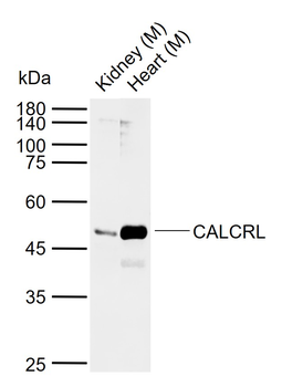 CALCRL Rabbit Polyclonal Antib