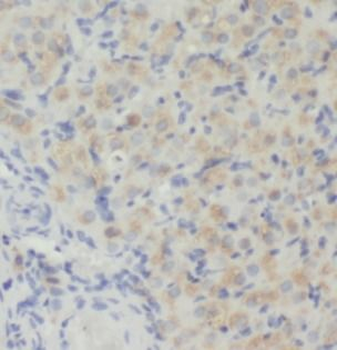 TGFB3 Antibody抗体，orb395673，bio