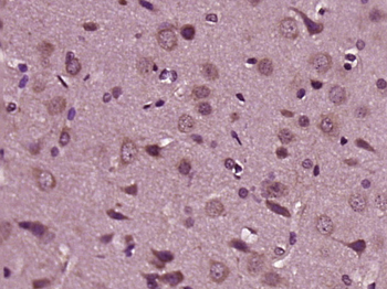 HRG beta 1 Rabbit Polyclonal A