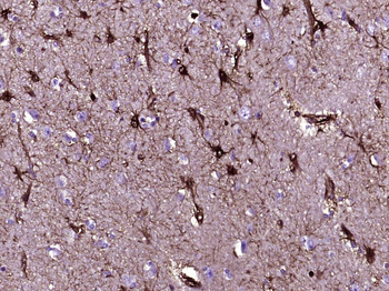 Galectin 3 Mouse Monoclonal An