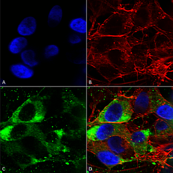 Nav1.8 Antibody (HRP)抗体，orb148