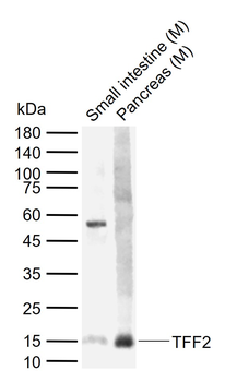 TFF2 Rabbit Polyclonal Antibod