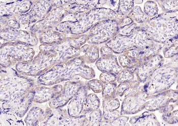 DIO2 Rabbit Polyclonal Antibod