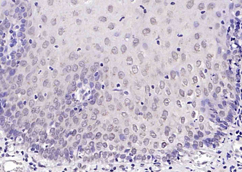 Phospho-P53 (Ser392) Rabbit Po