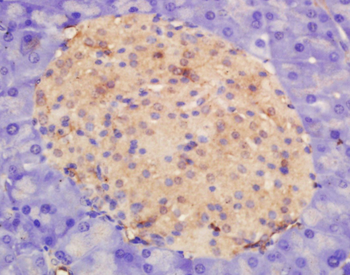 APOD Rabbit Polyclonal Antibod