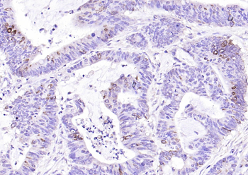 IL13RA2 Rabbit Polyclonal Anti