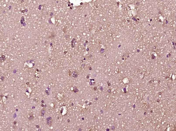 Phospho-RPS6KA1 (Thr348) Rabbi