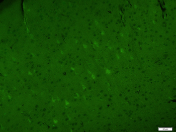 C-fos Rabbit Polyclonal Antibo
