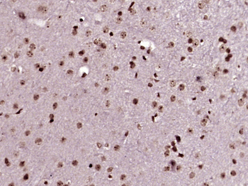 Phospho-TH (Ser31) Rabbit Poly