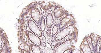 BARD1 Rabbit Polyclonal Antibo