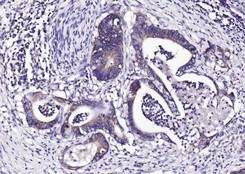 Phospho-PYK2 (Tyr402) Rabbit P