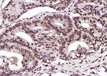 Phospho-Crkl (Tyr251) Rabbit P