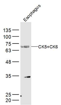CK5+CK6 Rabbit Polyclonal Anti