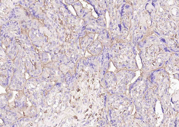PD-L1 Recombinant Rabbit Monoc