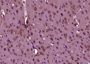 Phospho-Doublecortin (Ser47) R