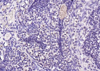 Mst2 Rabbit Polyclonal Antibod