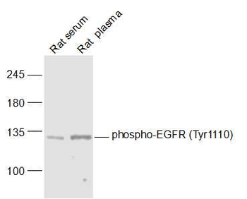 Phospho-EGFR (Tyr1110) Rabbit 