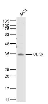 CDK6 Rabbit Polyclonal Antibod