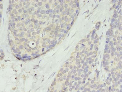 TMEM45A Antibody抗体,orb357227,b