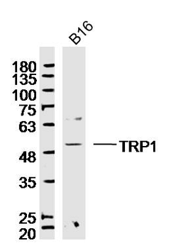 TYRP1 Rabbit Polyclonal Antibo